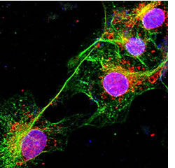 biomarcador_alzheimer