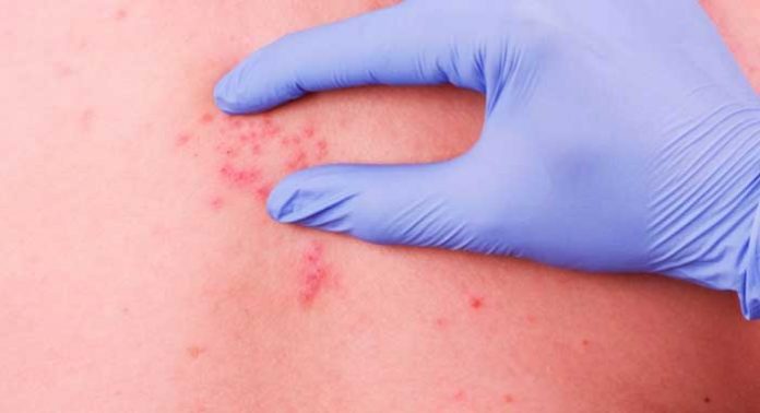 chirurgia per la perdita di peso e insonnia