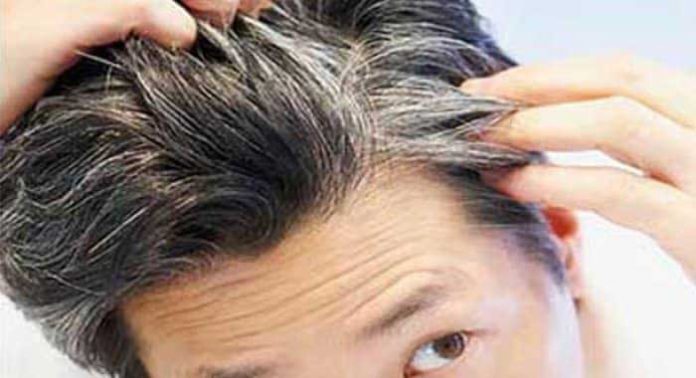 cabello-gris-y-enfermedadcardiaca