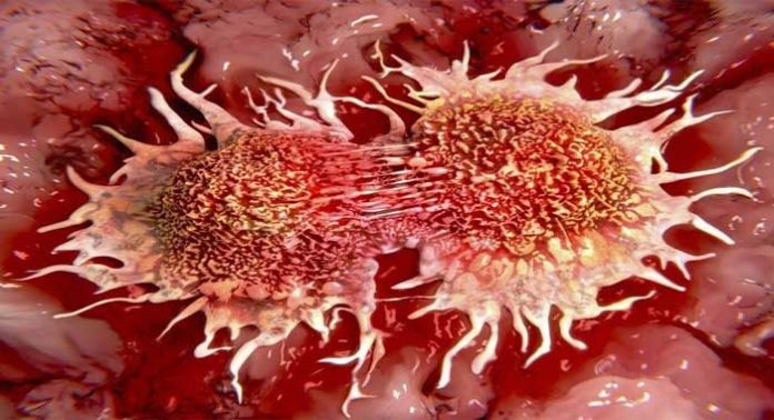metastasis-en-cancer