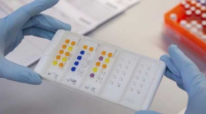 anticuerpos-de-laboratorio