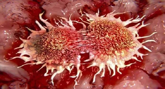 metastasis-y-posible-clave
